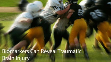 biomarkers-can-reveal-tramautic-brain-injury-293810