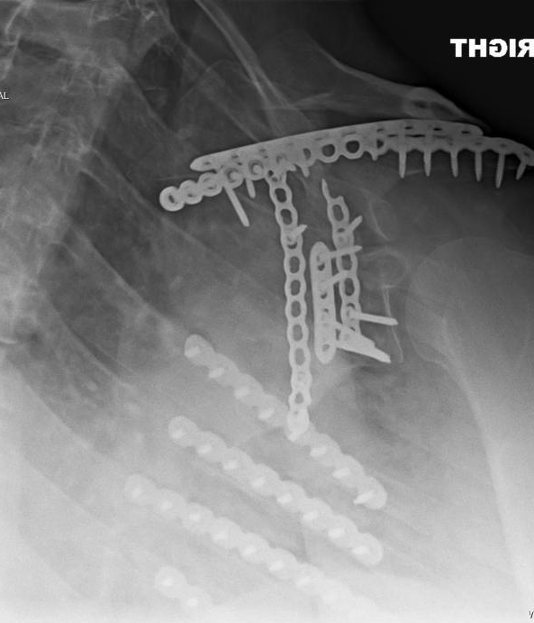 rearviewplatingjune2016